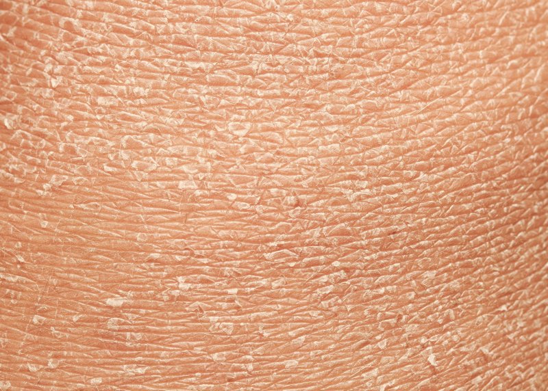 Кожа человеческая