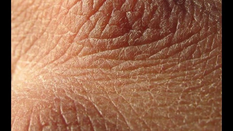 Кожа человеческая