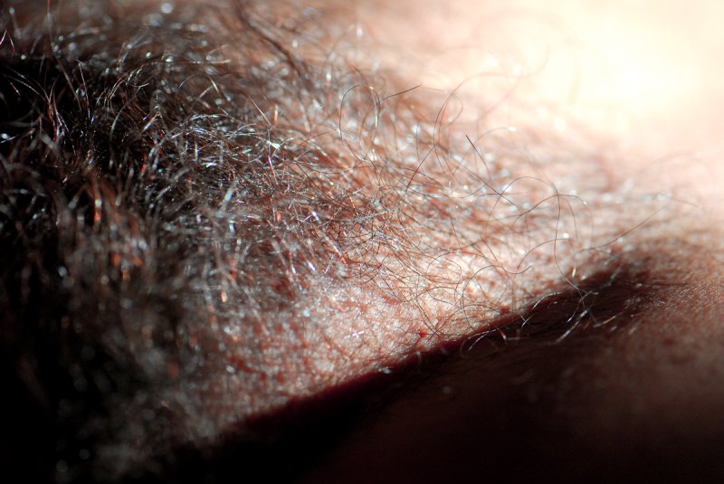 Лобковые волосы у женщин