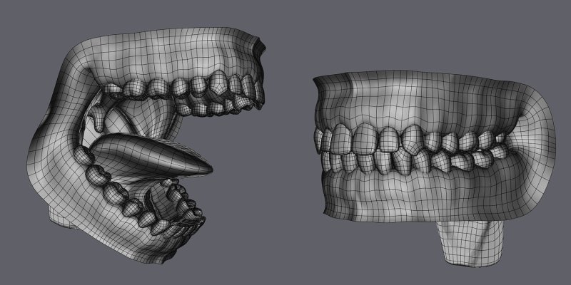Стереолитографическая модель челюсти