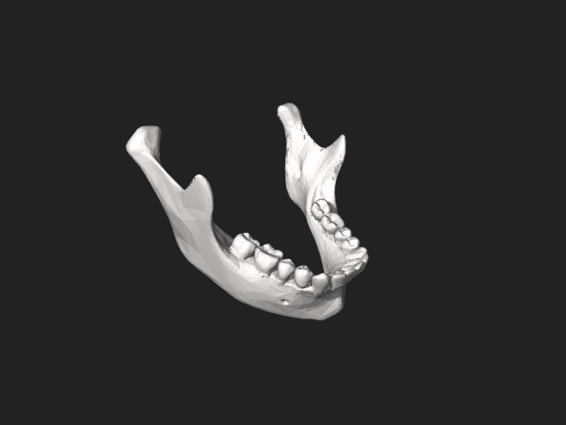 3д моделирование челюсти