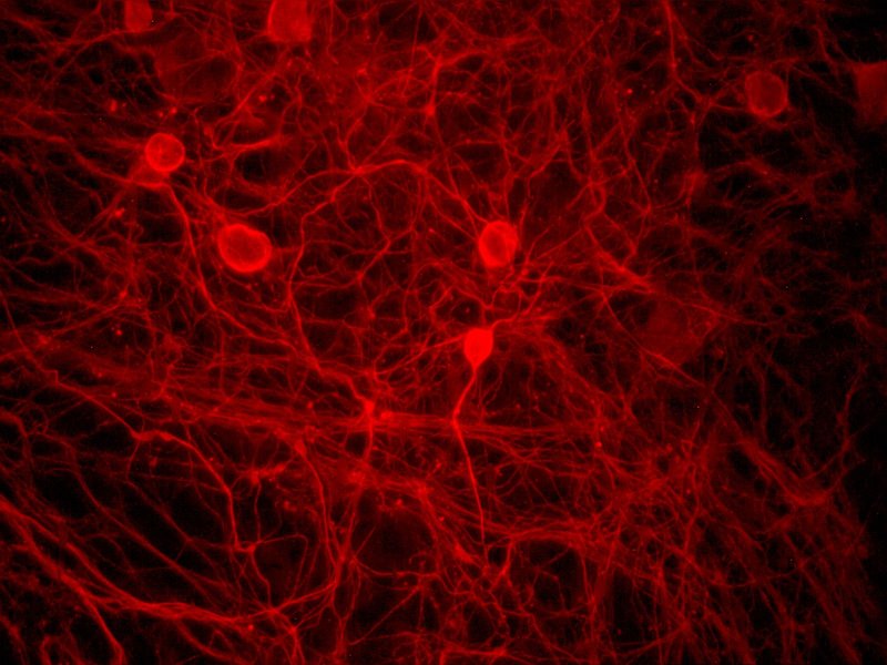 Кровеносные сосуды текстура