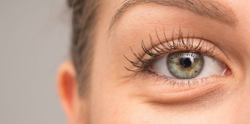 Мешки под глазами