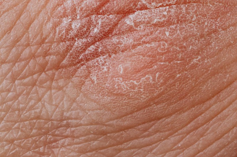 Кожа человеческая