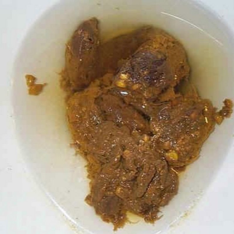 Человеческие экскременты